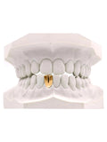 Singlecap Grillz Bottom Jetzt Konfigurieren